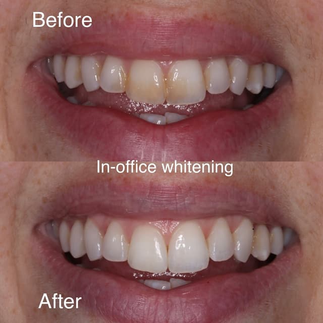 Professional Smiles photo