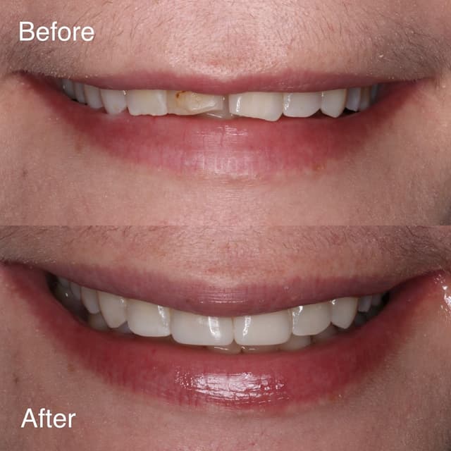 Professional Smiles photo
