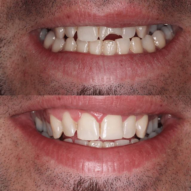 Professional Smiles photo