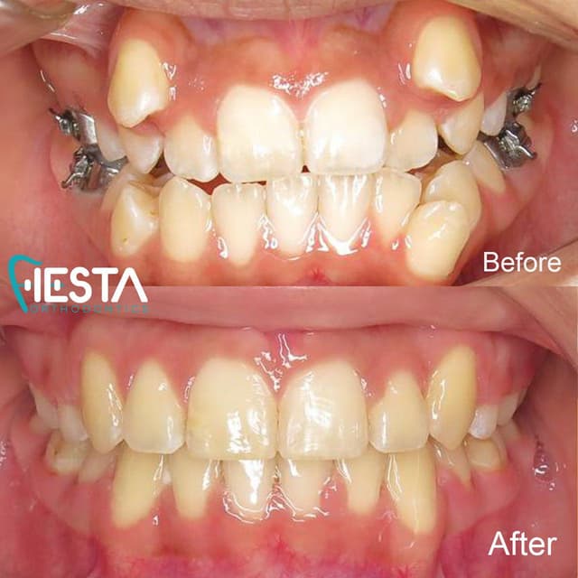 Fiesta Orthodontics photo
