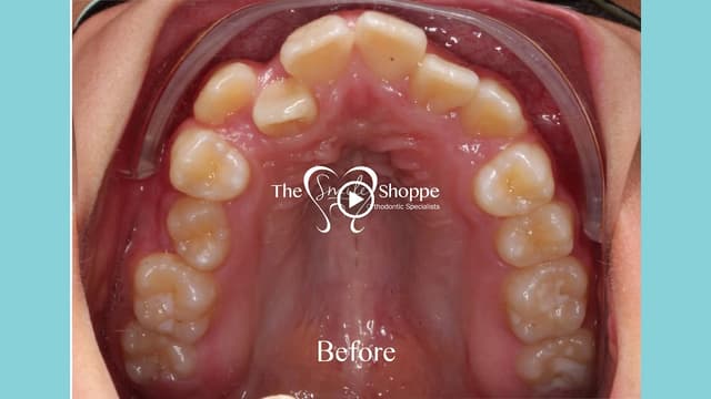 The Smile Shoppe Orthodontic Specialists photo