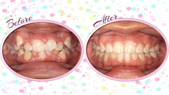 CC Braces, Corpus Christi Orthodontics photo