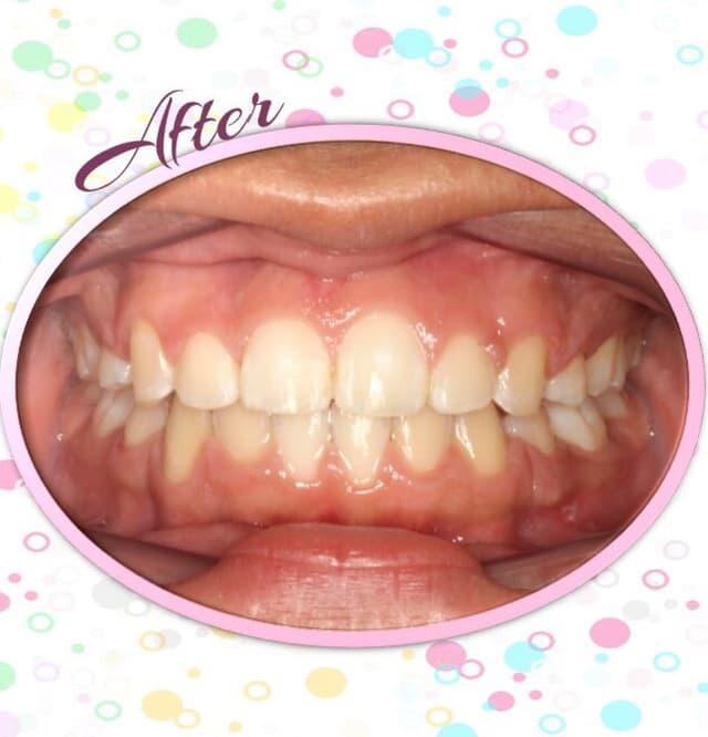 CC Braces, Corpus Christi Orthodontics photo