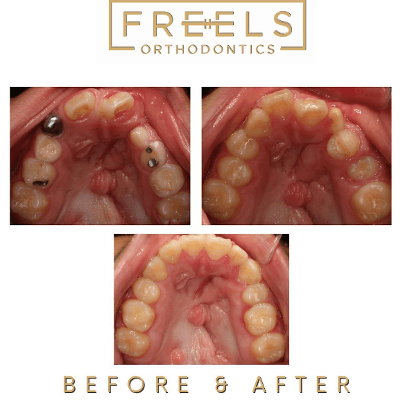 Freels Orthodontics photo