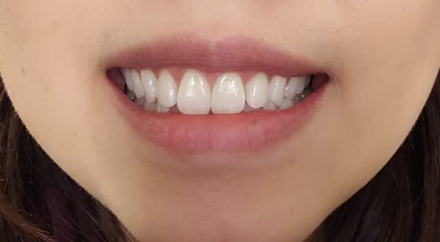 Handcrafted Smiles Villa Park photo