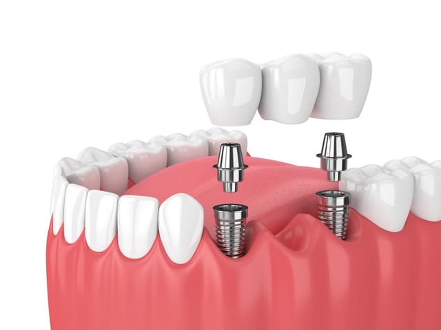 Altamonte Smiles photo