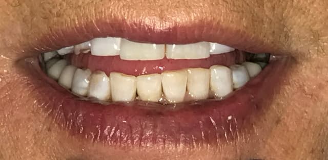 Carrollton Smiles photo