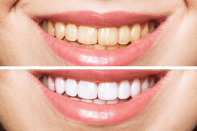 Smiles By Morel photo