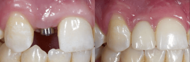 Bird and Johnson, Oral Surgery photo