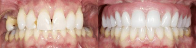 Bird and Johnson, Oral Surgery photo