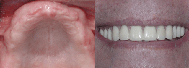 Bird and Johnson, Oral Surgery photo