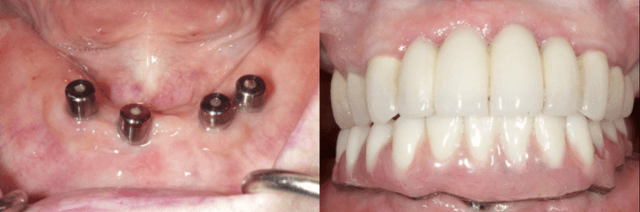 Bird and Johnson, Oral Surgery photo