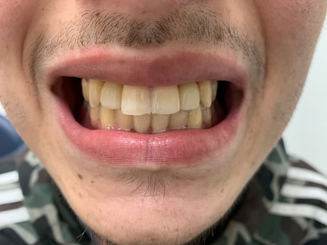 Implant Center of Coral Gables photo
