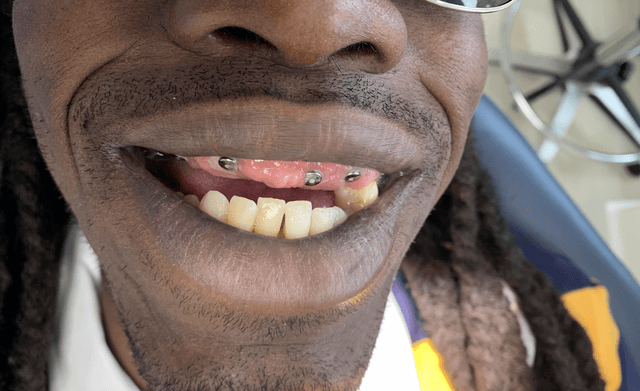 Implant Center of Coral Gables photo