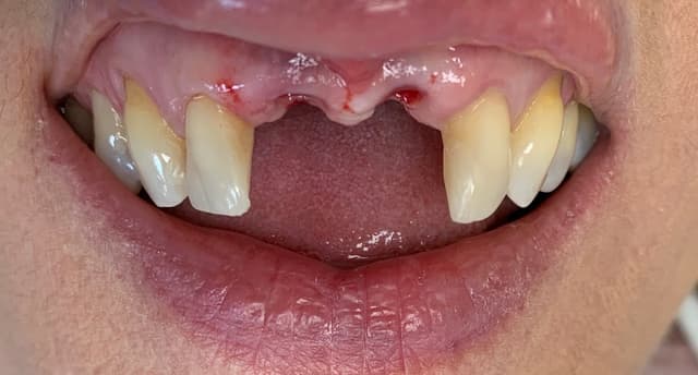 Implant Center of Coral Gables photo