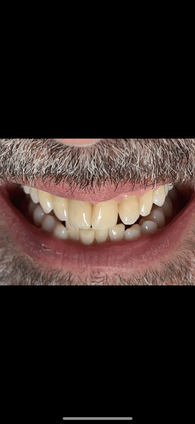 Implant Center of Coral Gables photo