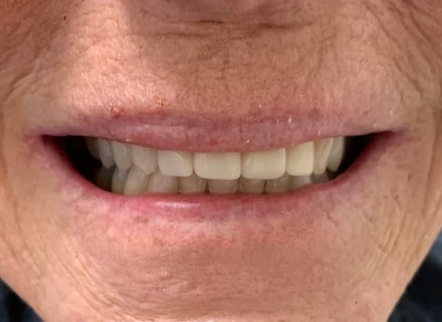 Implant Center of Coral Gables photo