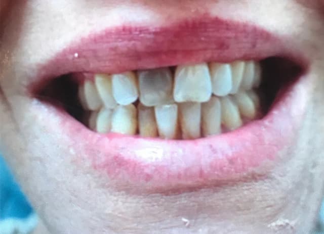 Implant Center of Coral Gables photo
