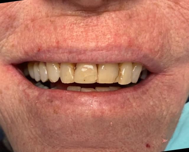 Implant Center of Coral Gables photo