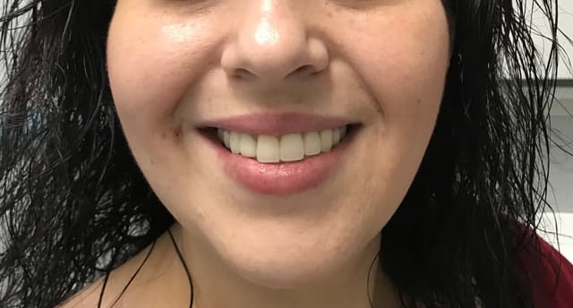 Implant Center of Coral Gables photo