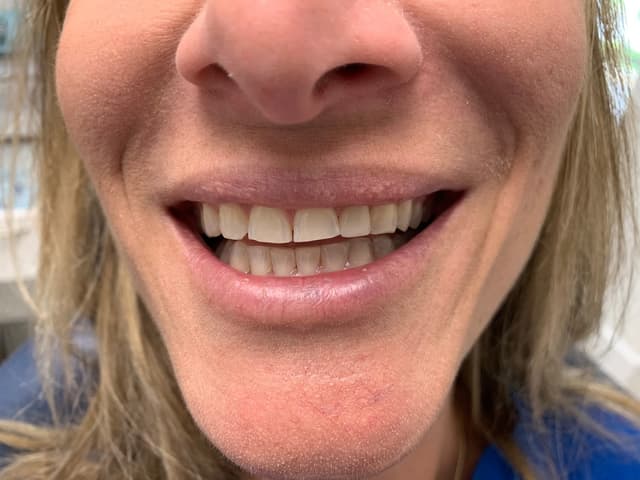 Implant Center of Coral Gables photo