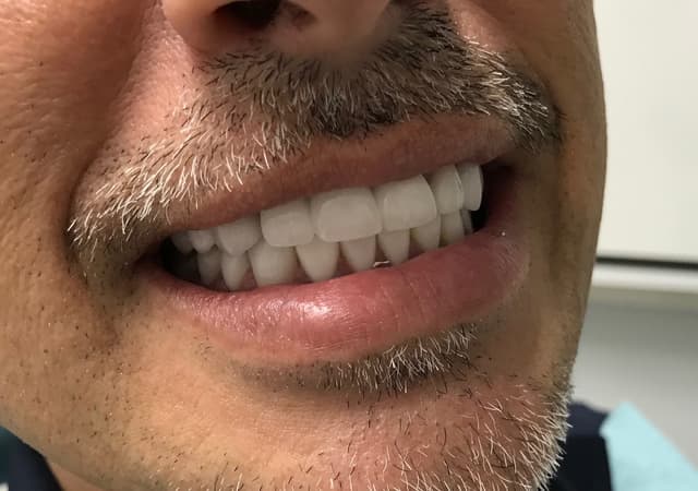 Implant Center of Coral Gables photo
