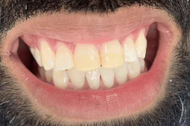 Implant Center of Coral Gables photo