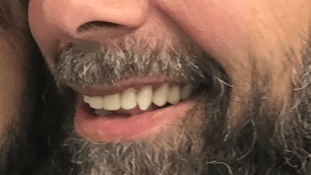 Implant Center of Coral Gables photo