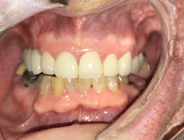 Implant Center of Coral Gables photo