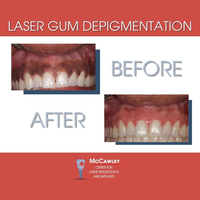 McCawley Center for Laser Periodontics & Implants photo