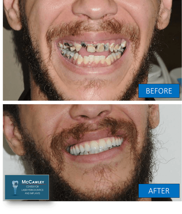 McCawley Center for Laser Periodontics & Implants photo