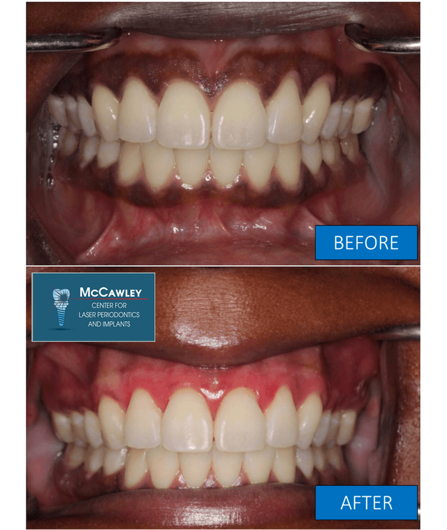 McCawley Center for Laser Periodontics & Implants photo