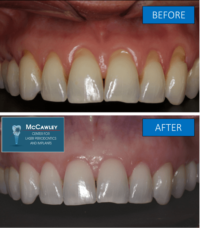 McCawley Center for Laser Periodontics & Implants photo