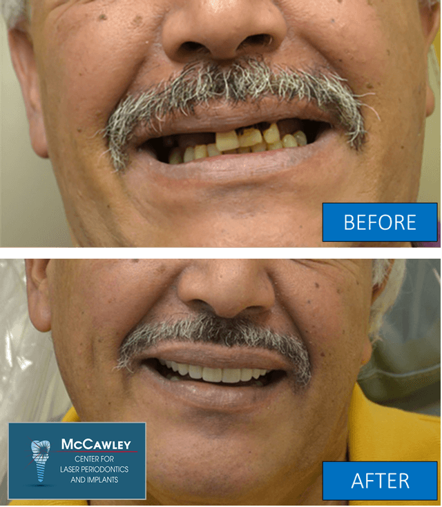 McCawley Center for Laser Periodontics & Implants photo