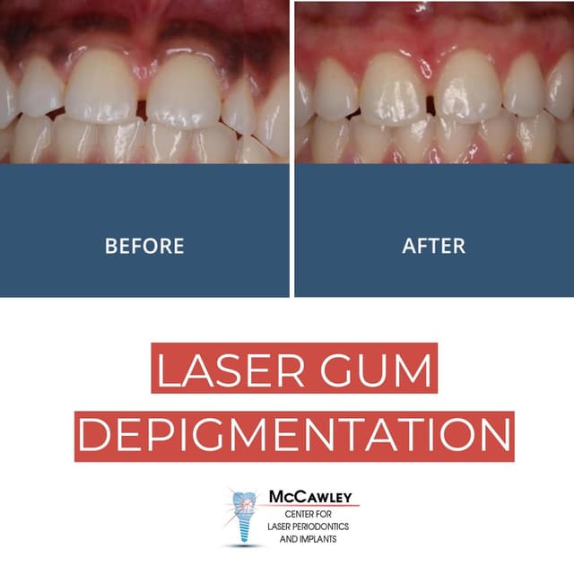 McCawley Center for Laser Periodontics & Implants photo