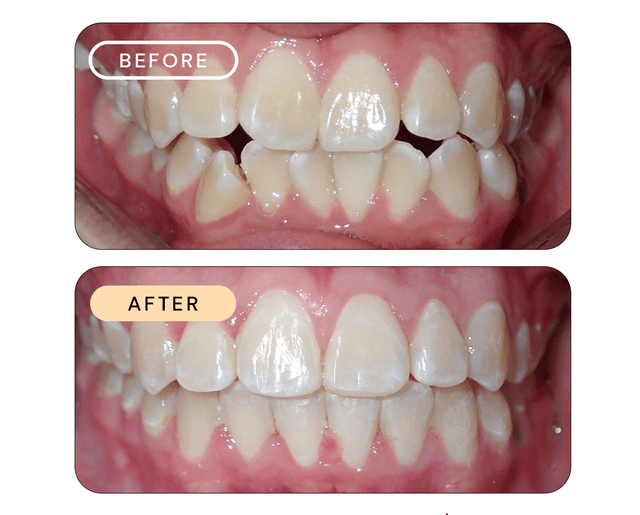 Purchase Park Orthodontics of Westchester photo