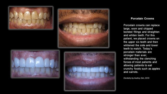 Algonquin Smiles photo
