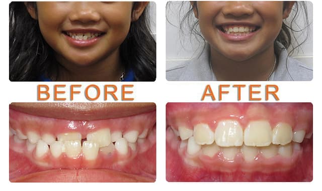 Viva Smiles photo