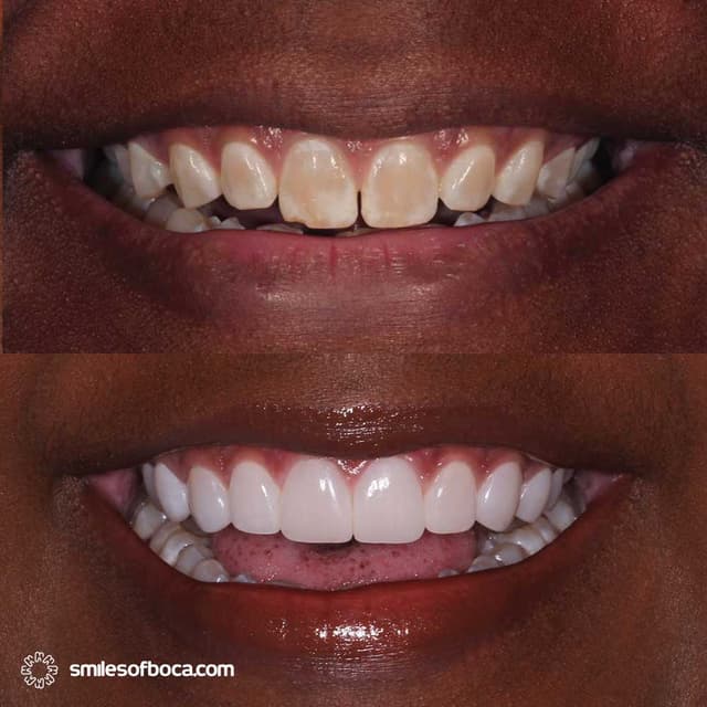 Smiles of Boca photo