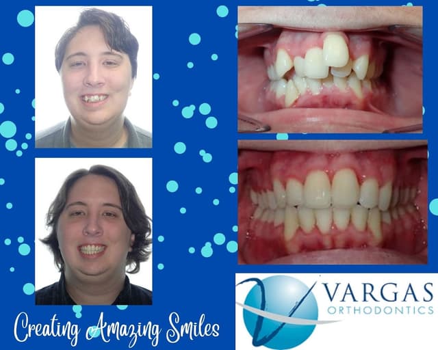 Vargas Orthodontics - Orthodontist, Braces, Invisalign photo