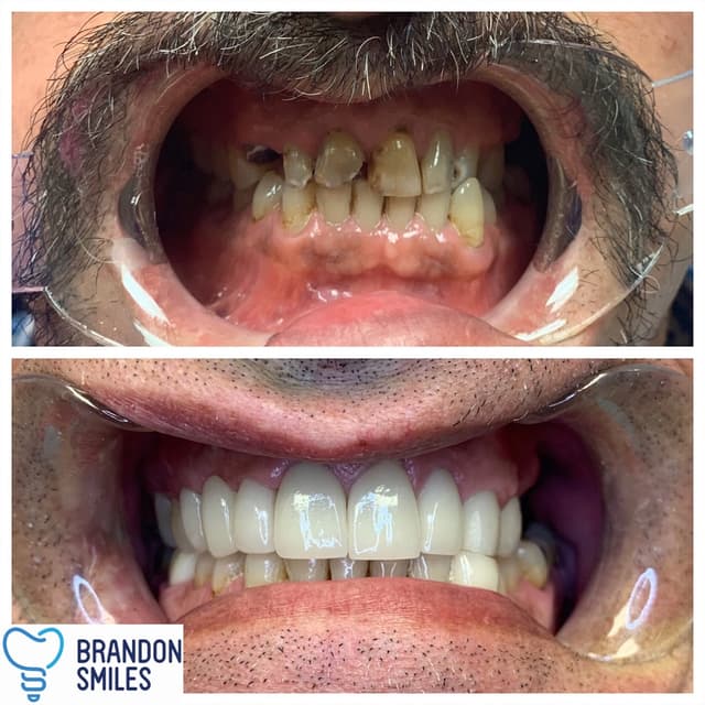 Brandon Smiles photo