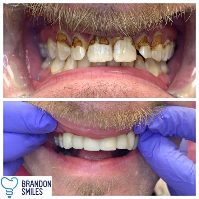 Brandon Smiles photo