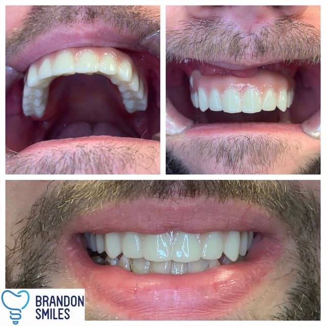 Brandon Smiles photo