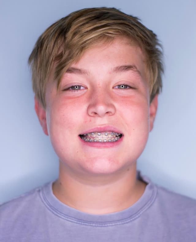 Putnam Orthodontics- Invisalign and Braces photo