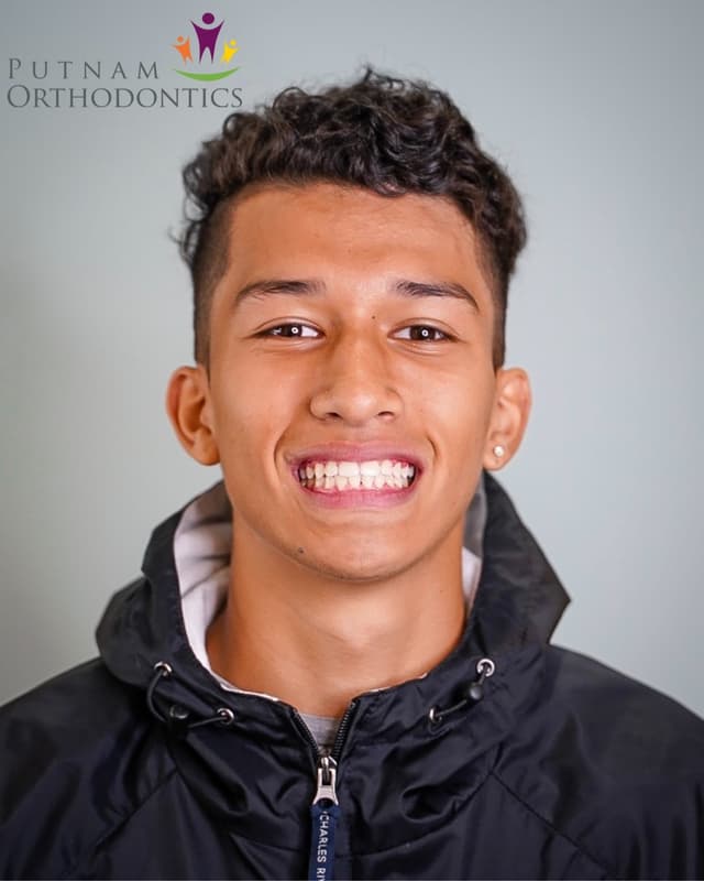 Putnam Orthodontics- Invisalign and Braces photo