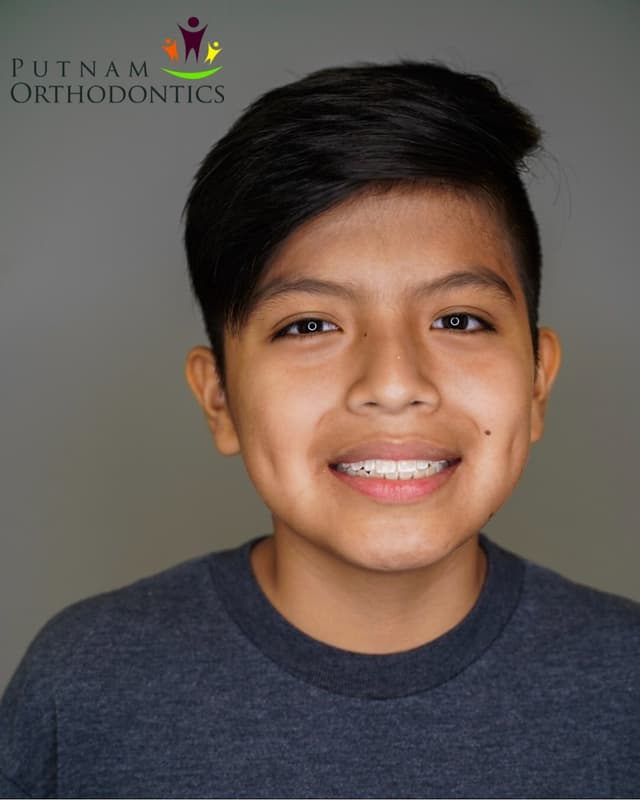 Putnam Orthodontics- Invisalign and Braces photo