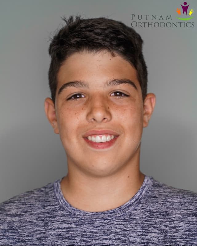 Putnam Orthodontics- Invisalign and Braces photo