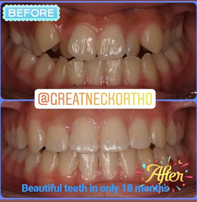 Great Neck Orthodontics PLLC photo