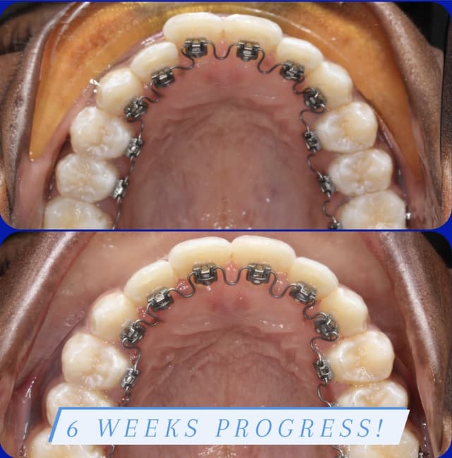Great Neck Orthodontics PLLC photo