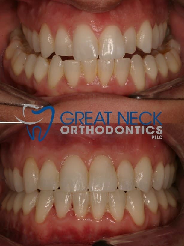 Great Neck Orthodontics PLLC photo